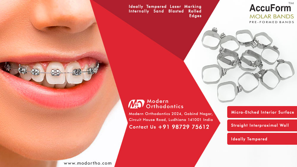 molar-bands-what-they-are-and-how-they-work